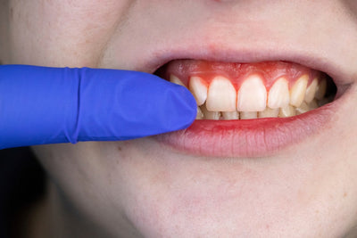 Protect Your Smile: The Importance of Seeing a Dental Hygienist